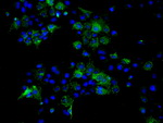ATP5B Antibody in Immunocytochemistry (ICC/IF)