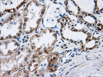 ATP5B Antibody in Immunohistochemistry (Paraffin) (IHC (P))
