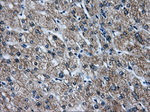 ATP5B Antibody in Immunohistochemistry (Paraffin) (IHC (P))