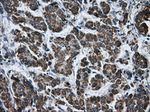 ATP5B Antibody in Immunohistochemistry (Paraffin) (IHC (P))