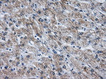 ATP5B Antibody in Immunohistochemistry (Paraffin) (IHC (P))