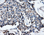 ATP5B Antibody in Immunohistochemistry (Paraffin) (IHC (P))