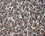 ATP5B Antibody in Immunohistochemistry (Paraffin) (IHC (P))