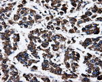 ATP5B Antibody in Immunohistochemistry (Paraffin) (IHC (P))