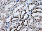 ATP5B Antibody in Immunohistochemistry (Paraffin) (IHC (P))