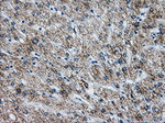 ATP5B Antibody in Immunohistochemistry (Paraffin) (IHC (P))