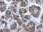 ATP5B Antibody in Immunohistochemistry (Paraffin) (IHC (P))