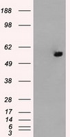ATP5B Antibody in Western Blot (WB)