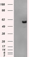 ATP5B Antibody in Western Blot (WB)