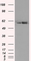 ATP5B Antibody in Western Blot (WB)