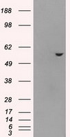 ATP5B Antibody in Western Blot (WB)