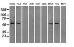 ATP5B Antibody in Western Blot (WB)
