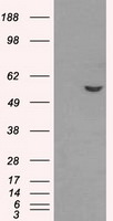ATP5B Antibody in Western Blot (WB)
