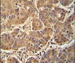 ATP5D Antibody in Immunohistochemistry (IHC)