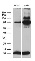 ATP5I Antibody in Western Blot (WB)