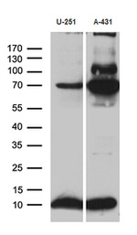 ATP5I Antibody in Western Blot (WB)