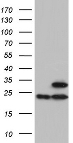 ATP5O Antibody in Western Blot (WB)