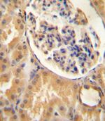 ATP6V0A1 Antibody in Immunohistochemistry (IHC)