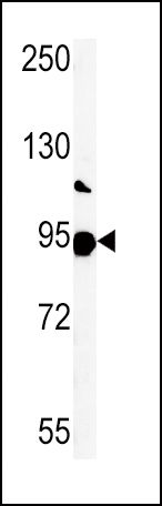ATP6V0A1 Antibody in Western Blot (WB)