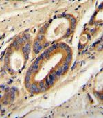 ATP6V0B Antibody in Immunohistochemistry (IHC)