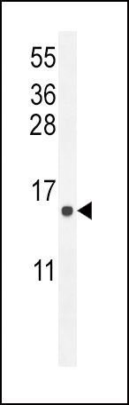 ATP6V0B Antibody in Western Blot (WB)