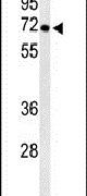 ATP6V1A Antibody in Western Blot (WB)