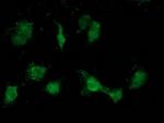 ATP6V1B1 Antibody in Immunocytochemistry (ICC/IF)