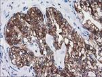ATP6V1B1 Antibody in Immunohistochemistry (Paraffin) (IHC (P))