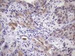 ATP6V1C2 Antibody in Immunohistochemistry (Paraffin) (IHC (P))