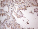 ATP6V1C2 Antibody in Immunohistochemistry (Paraffin) (IHC (P))