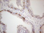 ATP6V1C2 Antibody in Immunohistochemistry (Paraffin) (IHC (P))