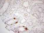 ATP6V1C2 Antibody in Immunohistochemistry (Paraffin) (IHC (P))
