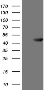 ATP6V1C2 Antibody in Western Blot (WB)