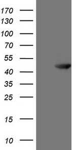 ATP6V1C2 Antibody in Western Blot (WB)