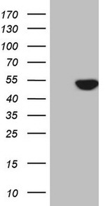 ATP6V1C2 Antibody in Western Blot (WB)