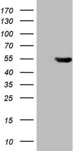 ATP6V1C2 Antibody in Western Blot (WB)