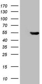 ATP6V1C2 Antibody in Western Blot (WB)