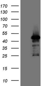 ATP6V1C2 Antibody in Western Blot (WB)