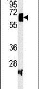 V-ATPase H Antibody in Western Blot (WB)