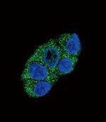 ATP7B Antibody in Immunocytochemistry (ICC/IF)