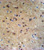 ATP7B Antibody in Immunohistochemistry (IHC)