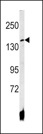 ATP7B Antibody in Western Blot (WB)
