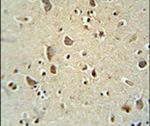 ATPGD1 Antibody in Immunohistochemistry (IHC)
