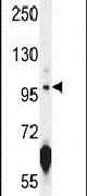 ATPGD1 Antibody in Western Blot (WB)