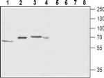 Neurokinin 1 Receptor (NK1R) (extracellular) Antibody in Western Blot (WB)