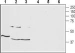 TRHR1 Antibody in Western Blot (WB)