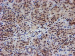 ATRIP Antibody in Immunohistochemistry (Paraffin) (IHC (P))