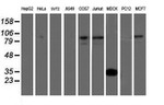 ATRIP Antibody in Western Blot (WB)