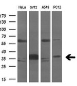 AURKC Antibody in Western Blot (WB)