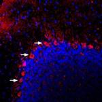 PACAP Receptor 1 (PAC1) Polyclonal Antibody